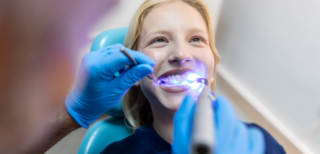 Professional Teeth Whitening: How To Get A Sparkling Smile Before Valentine’s Day?